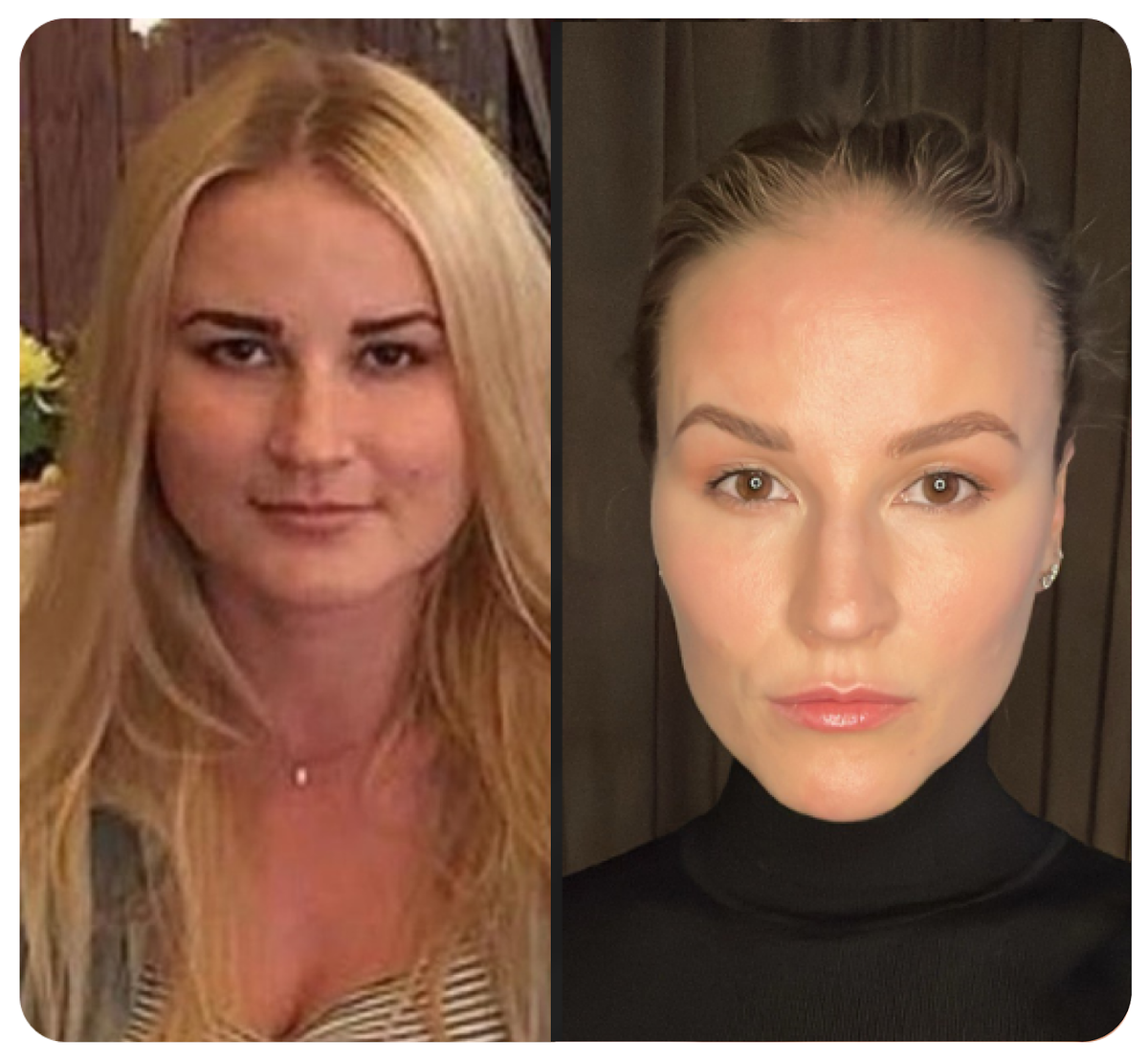 На фото 26 лет и 38 лет 