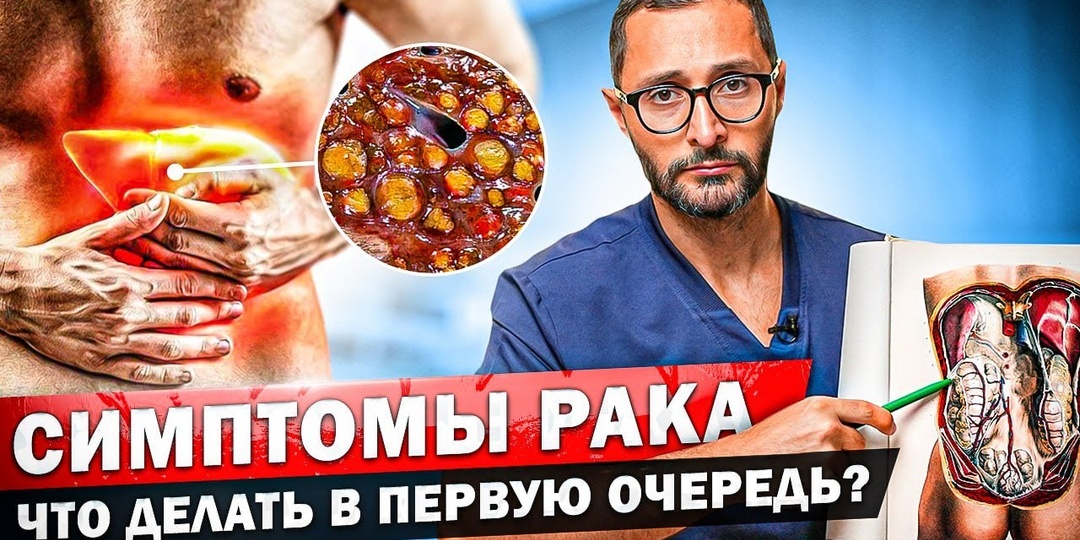 Онколог рассказал, где чаще всего «прячутся» первые опухоли (интервью)