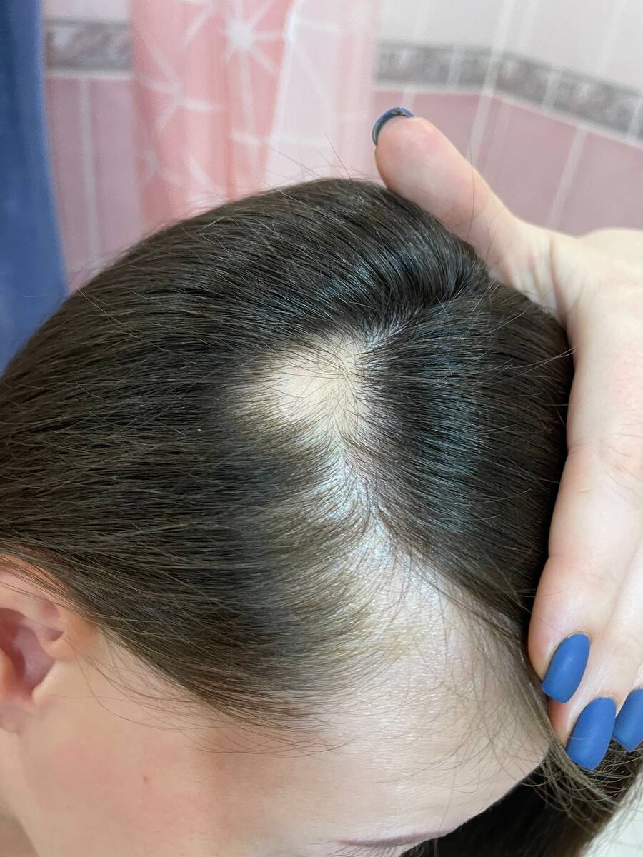 «Вспоминаю те времена... Бесконечные походы по врачам и уколы в голову. Спойлер: это не очень-то помогало.»