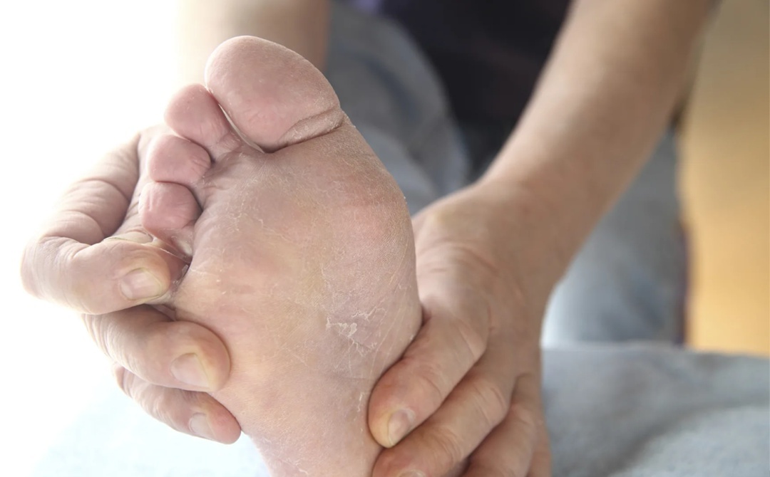 Вы ощущаете жжение и зуд в области стопы и пальцев ног? - Немедленно к подологу!