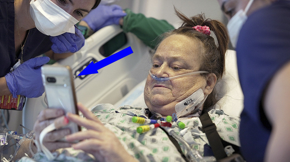    Уникальная операция с участием генно-модифицированной свиной почки и сердечного насоса завершилась трагедией