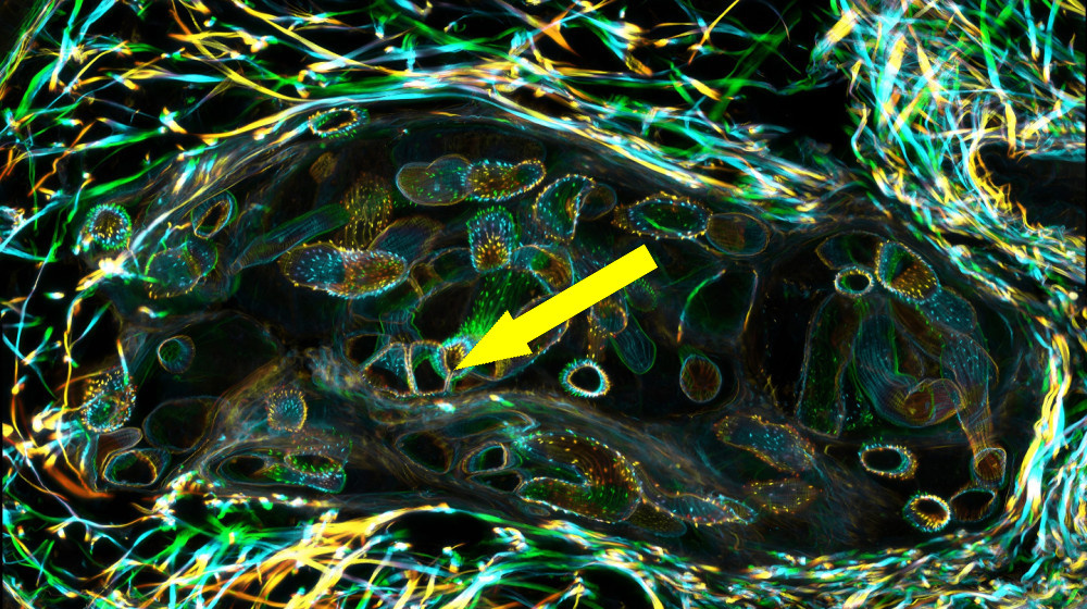    Новый прорыв в ИИ помогает выявлять заражение паразитами на ранних стадиях