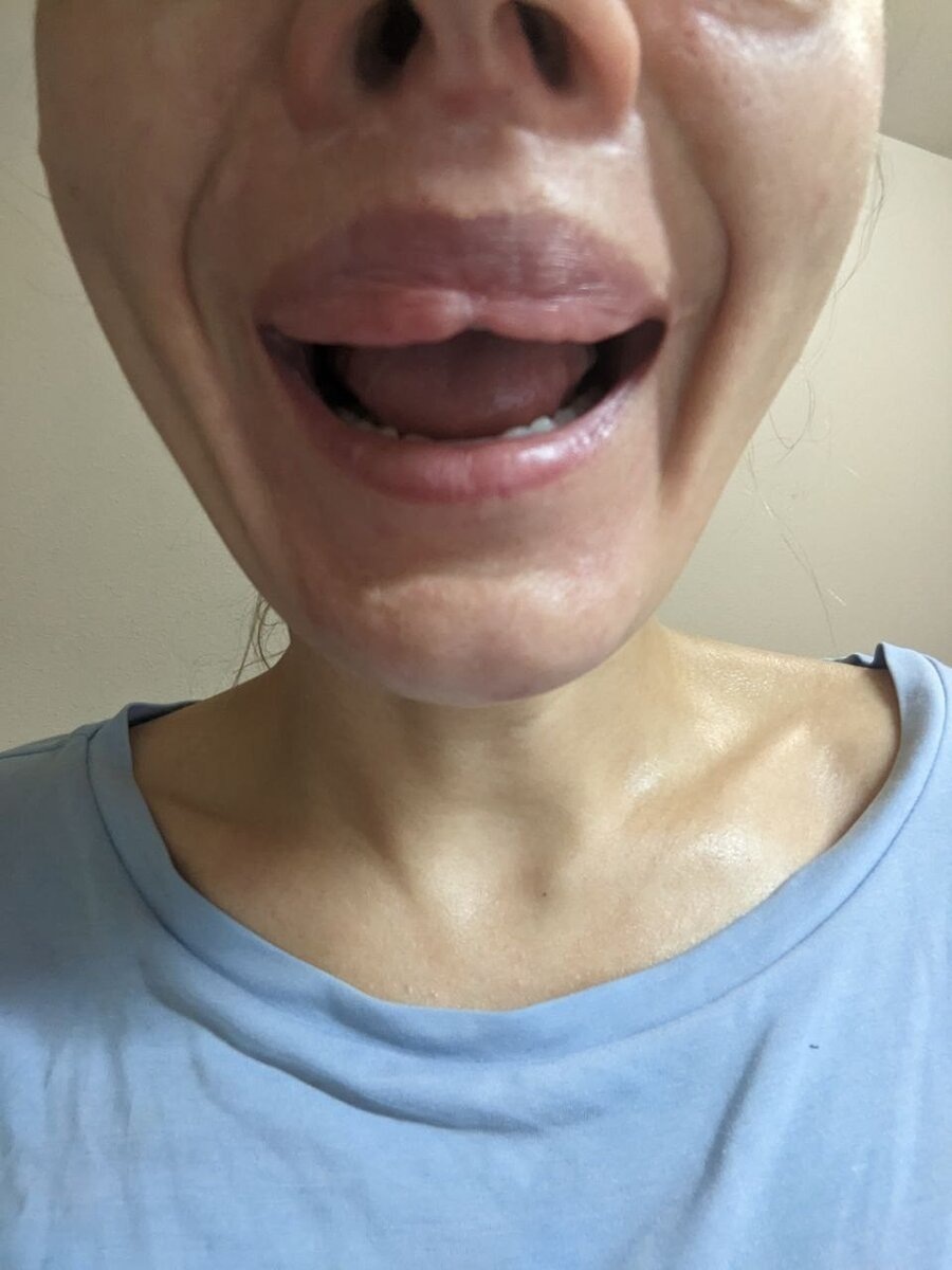 После операции Екатерина лишилась работы в танцевальном шоу в Лас-Вегасе. Фото: предоставлено "КП" героем публикации.