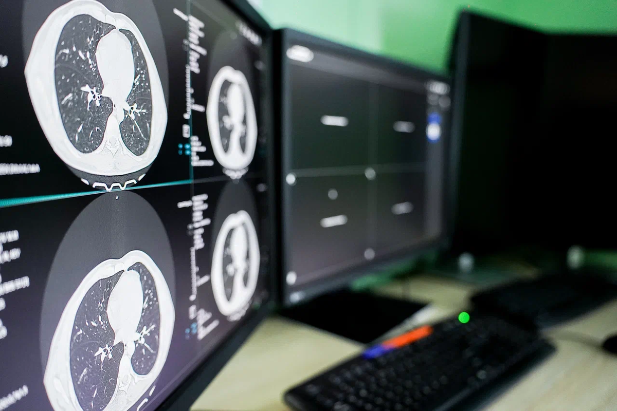 Маммография vs УЗИ, низкодозная КТ лёгких и DXA: когда идти и что выбрать. Клиника "Здоровье 365", Екатеринбург