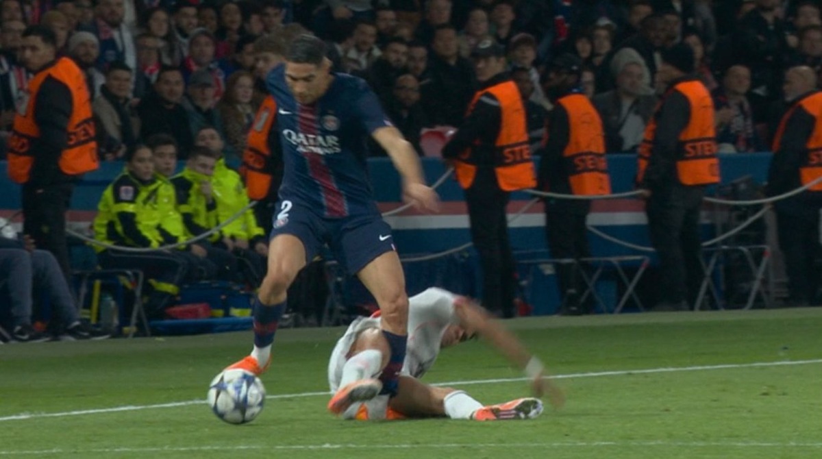     Травма Хакими