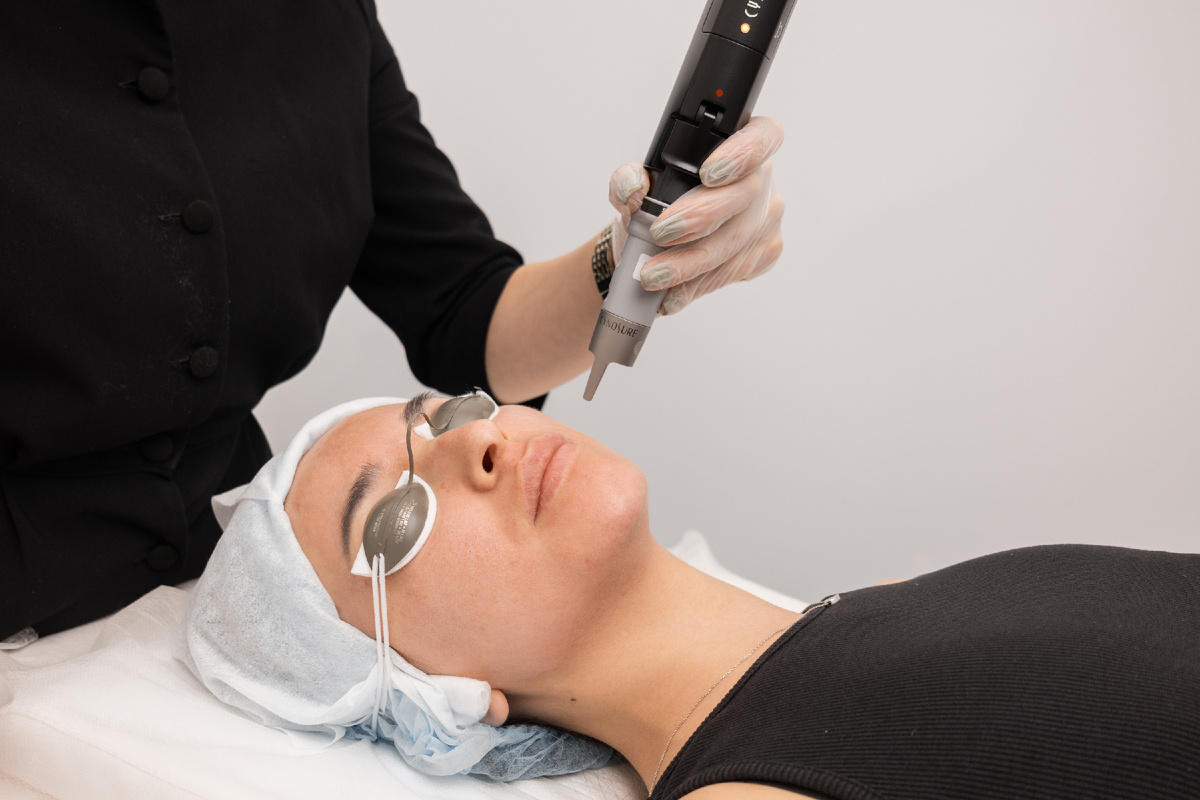 В результате сосуды становятся видимыми, а кожа - чувствительной и склонной к покраснениям