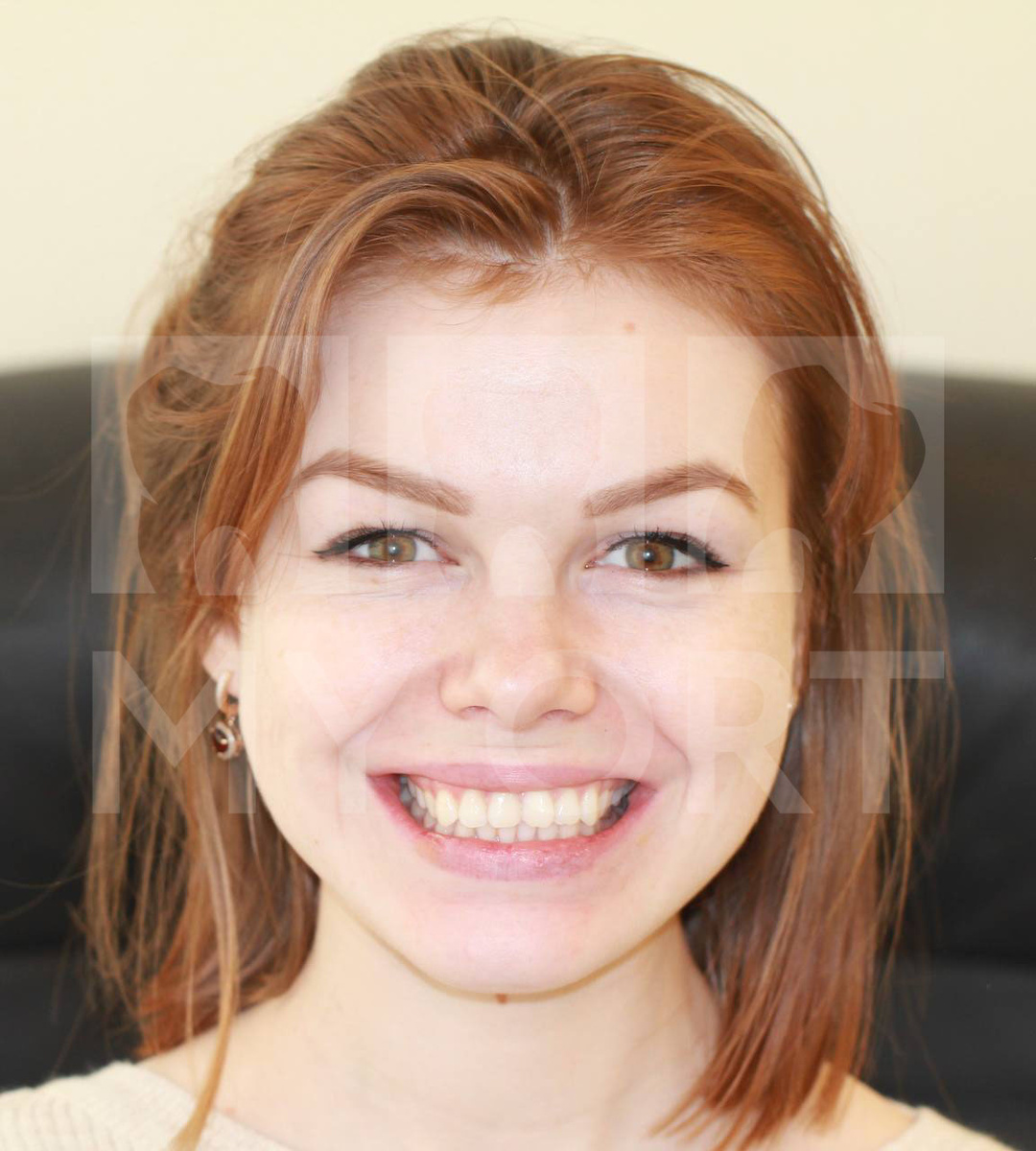 Фото пациентки до лечения ->