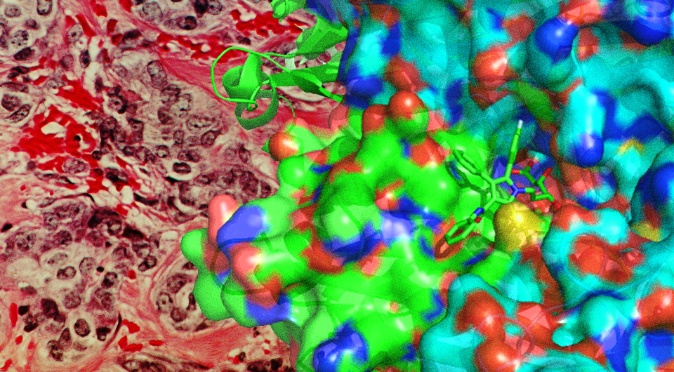   N + 1; Dr. Cecil Fox / National Cancer Institute / Flickr / Public domain; A2-33 / Wikimedia Commons / CC-BY-SA-3.0