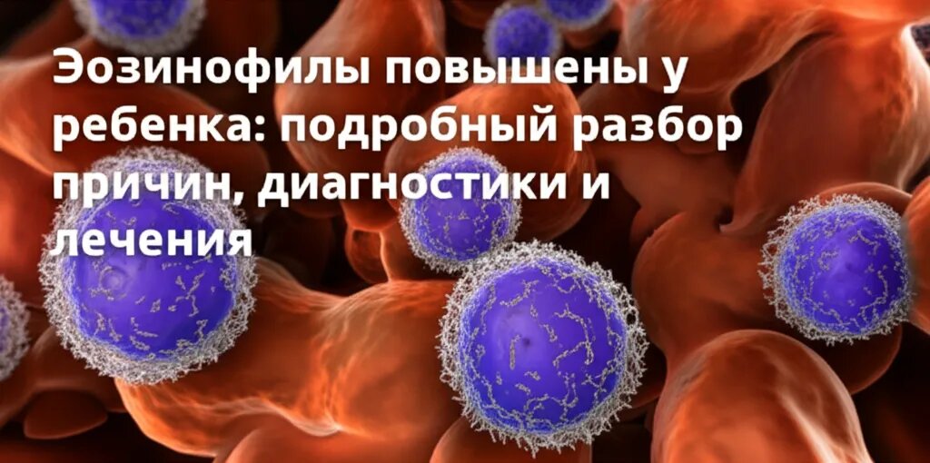    Эозинофилы повышены у ребенка: подробный разбор причин, диагностики и лечения Гиппократ Бальзамов