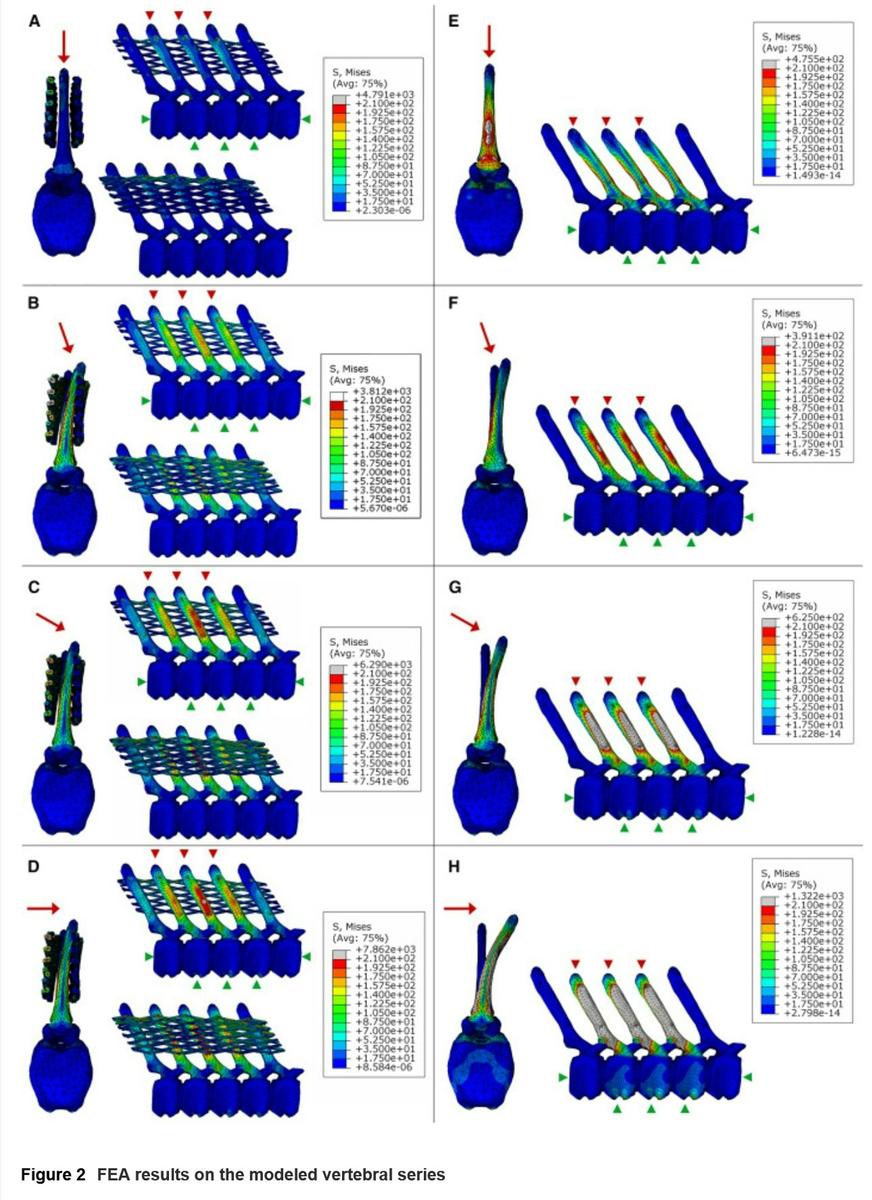 Иллюстрация, показывающая возможное смещение отростков позвонков при влиянии силы