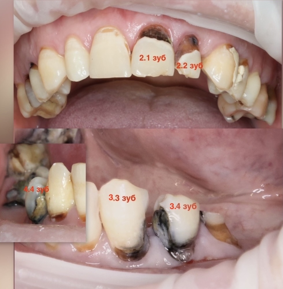 Состояние до