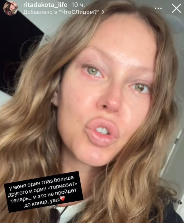 Скриншот публикации Риты Дакоты в запрещенной соцсети.