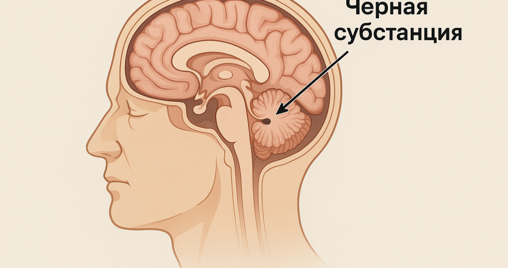 Болезнь Паркинсона: современные подходы к лечению