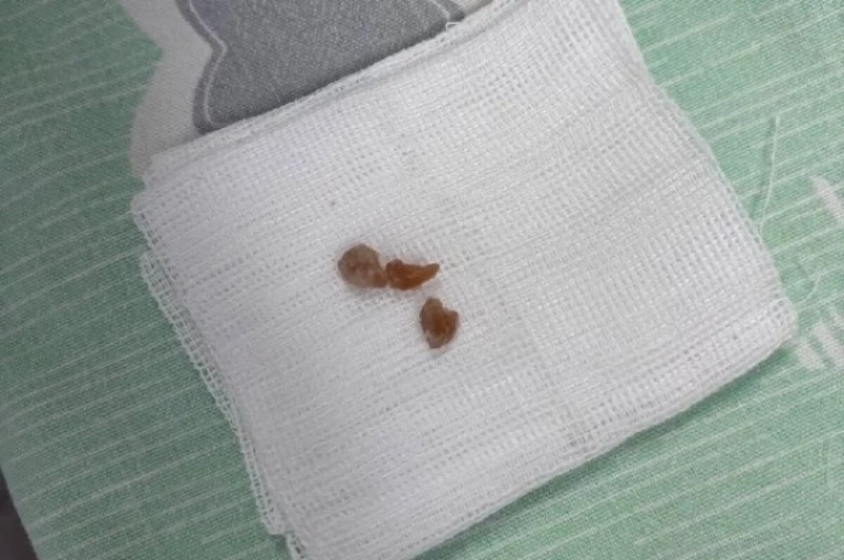    Малыш был увлечён игрой и в какой-то момент резко вдохнул арахис в сахарной глазури.