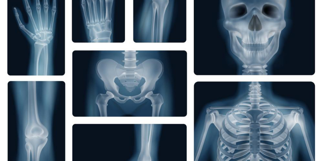 РЕНТГЕН И ТАК ДАЛЕЕ