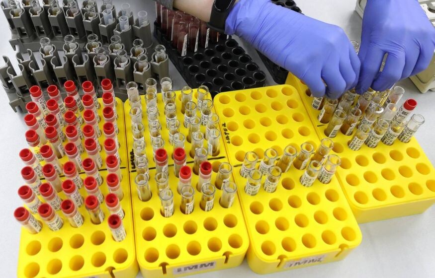    Революция в медицине: в России придумали первый в мире быстрый тест на гепатит С — диагноз за 25 минут!