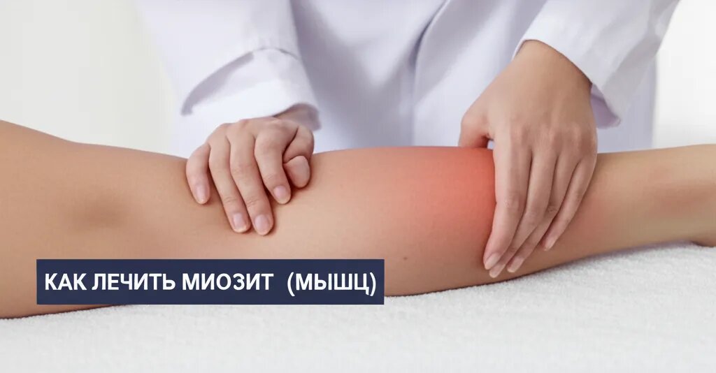    Как лечить миозит (воспаление мышц) Гиппократ Бальзамов