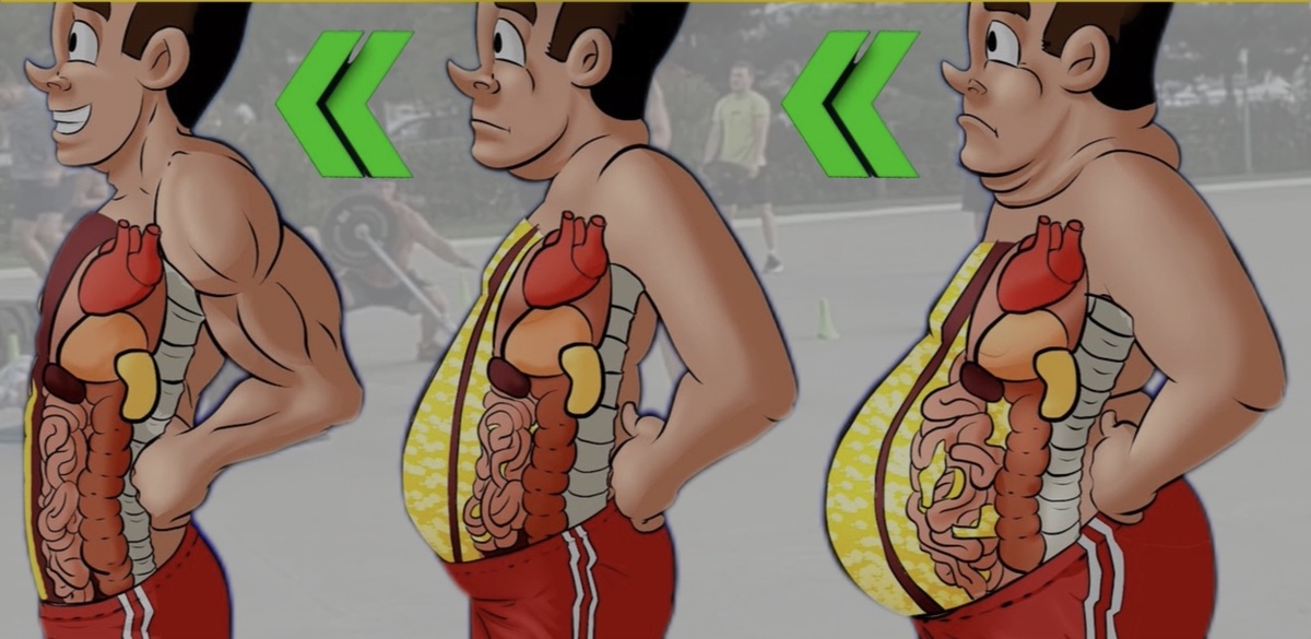 Накопление висцерального жира