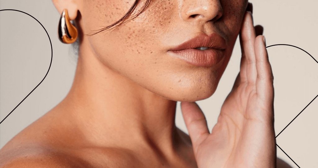 Топ-7 лучших средств от пигментных пятен