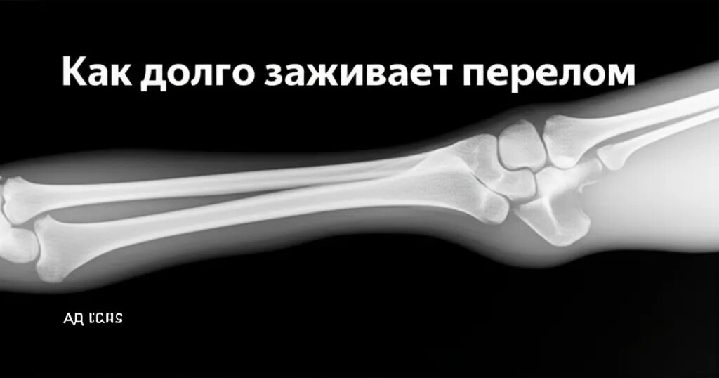    Как долго заживает перелом Гиппократ Бальзамов