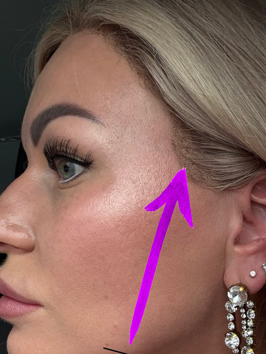 Вот она, магия! Видите эту сеточку? Именно она создает иллюзию "своих" волос. Это называется Lace Front.