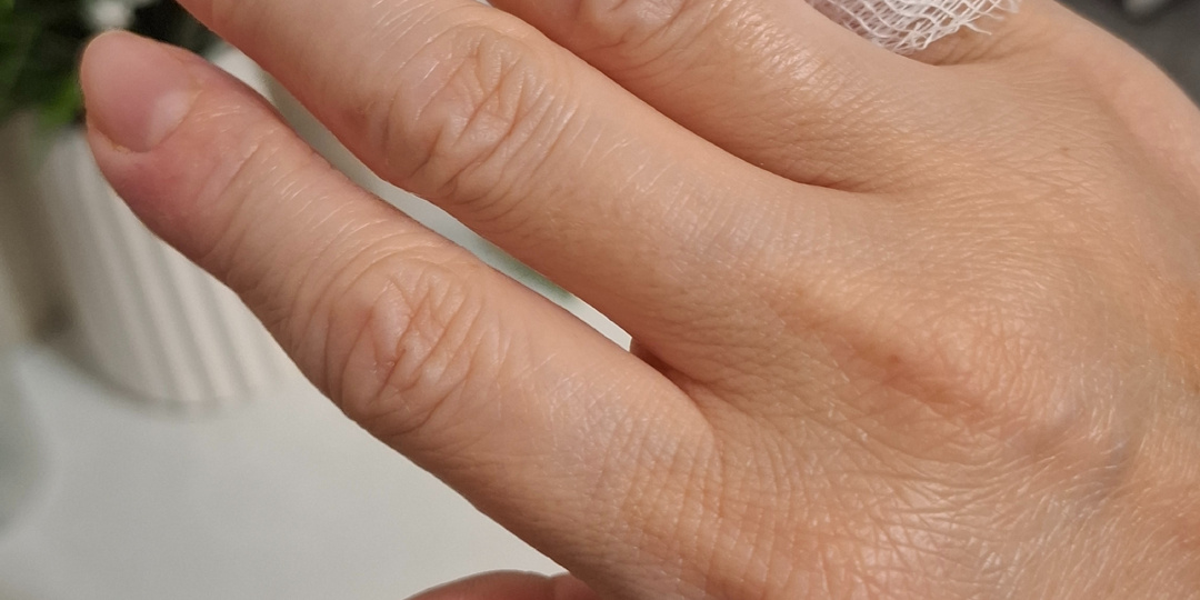 А вот и последствия после Гель лака😥