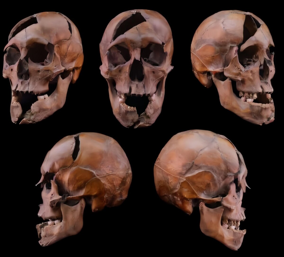 Череп герцога из доминиканского монастыря XIII века на острове Маргит в Будапеште, фото:Eötvös Loránd University