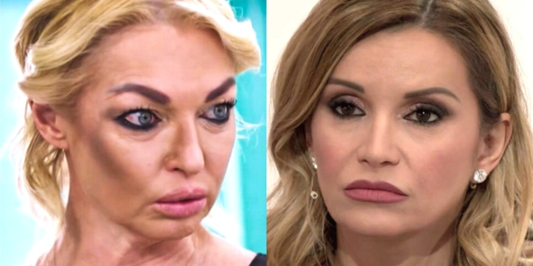 Поехавшие лица. 11 российских селебрити с осложнениями после пластических операций