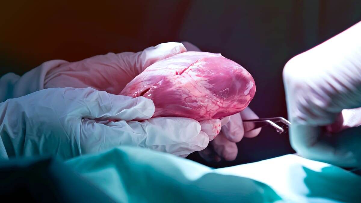    Хирурги проводят операцию по трансплантации сердца / © Kriangkrai Thitimakorn/Getty Images