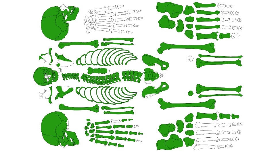   Satu Valoriani et al. / International Journal of Paleopathology, 2025