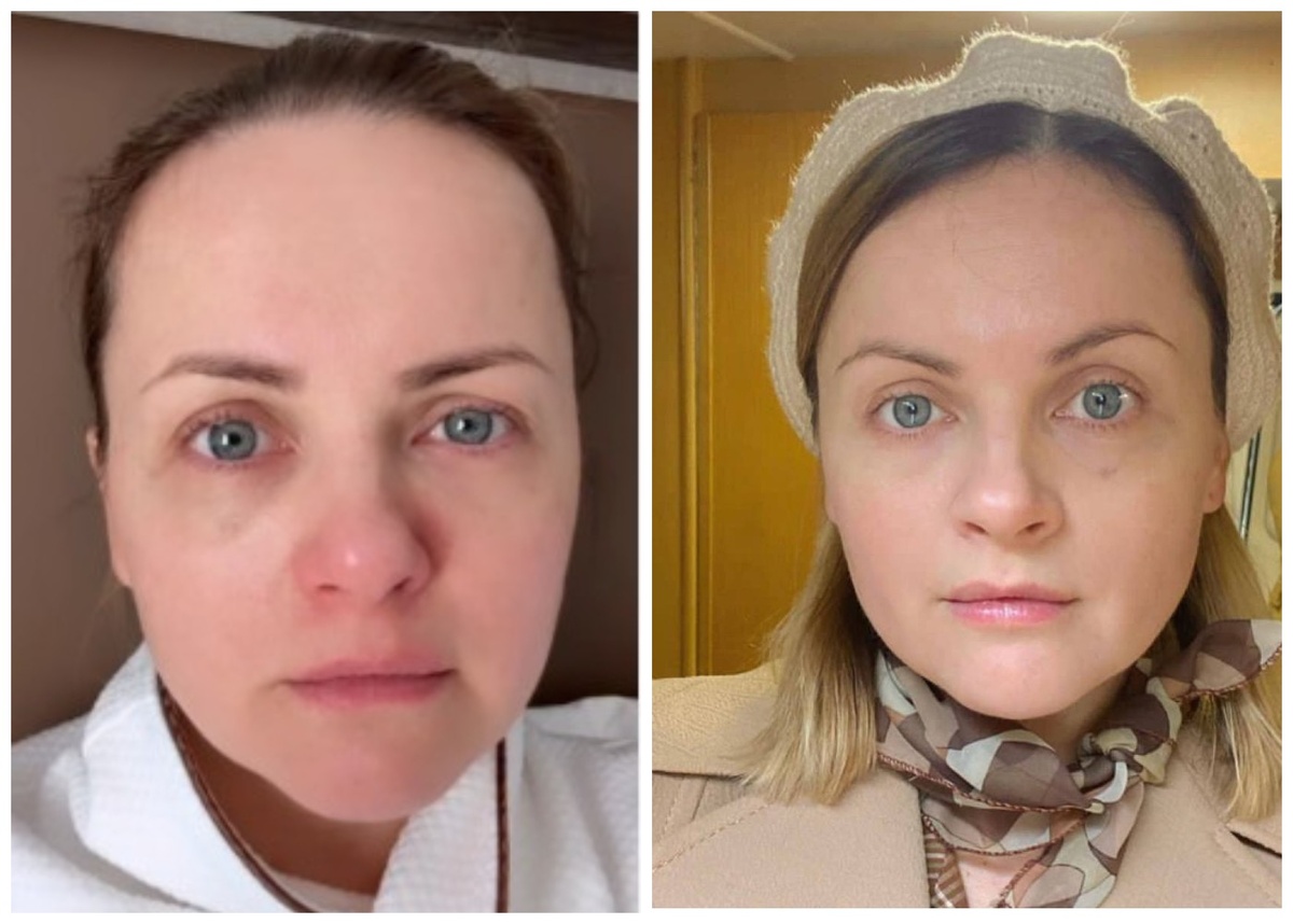 источник фото - интернет