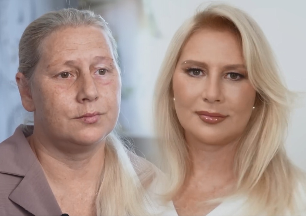 ИМЕЮТСЯ ПРОТИВОПОКАЗАНИЯ, НЕОБХОДИМА КОНСУЛЬТАЦИЯ СПЕЦИАЛИСТА