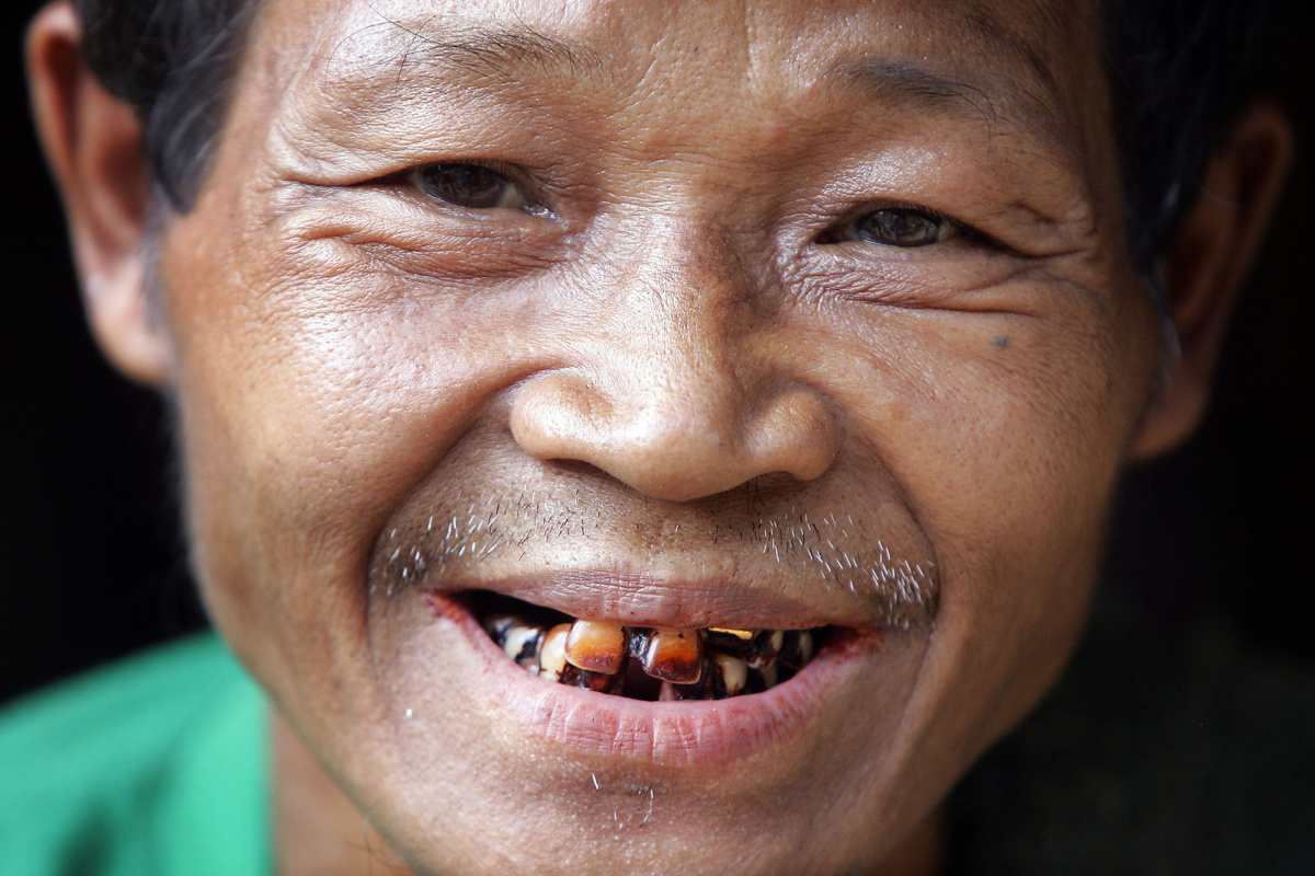     Жевание бетелевой жвачки в том числе приводит к проблемам с зубами и дёснами / AP / David Longstreath