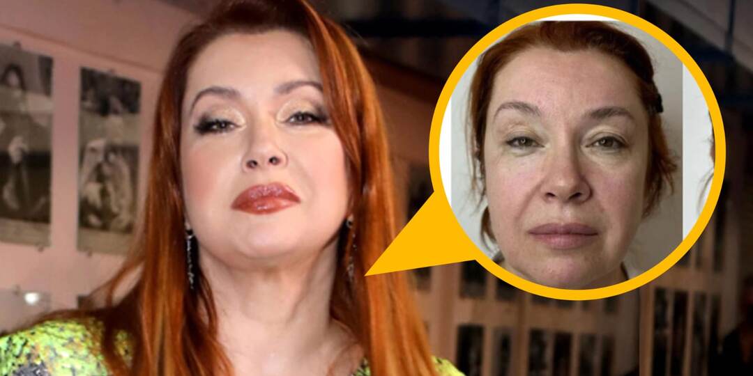 Лицо с дыркой и долг в 1,5 миллиона. Стычка Веры Сотниковой и косметолога, которая заманила звезду в кредитную ловушку