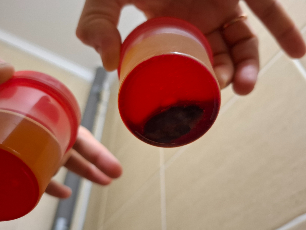 Что-то зарождается на дне банки