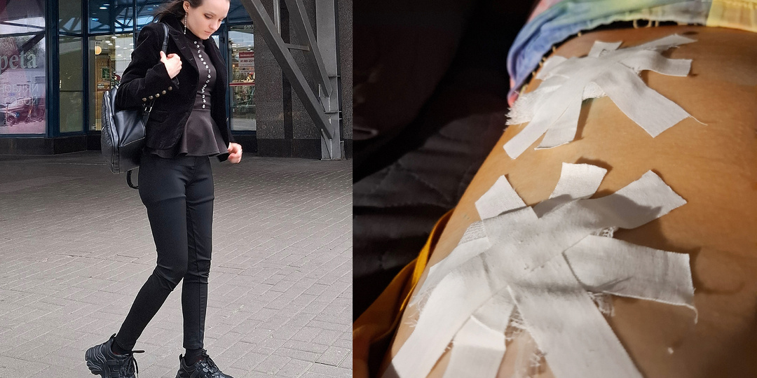 Грязные операционные. Грабеж в платной клинике. История болезни ч. 100