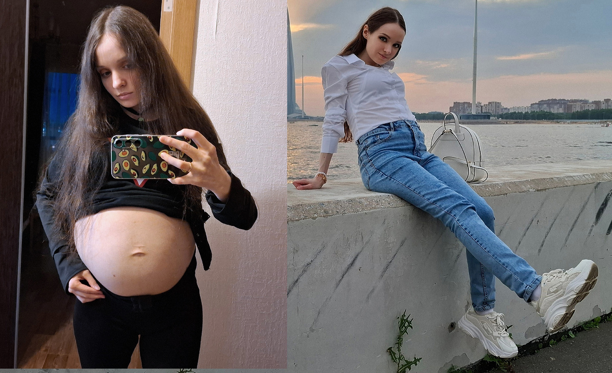 Слева - июнь 2025 (до лапароскопии), справа - июль 2025 (после лапароскопии)