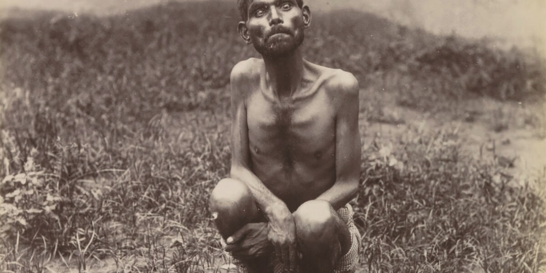 Настоящий Маугли умер от туберкулеза в 34 года. История, которую Киплинг не решился рассказать