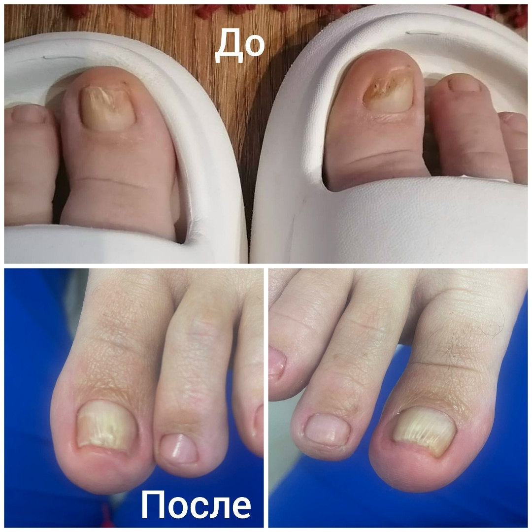 Работа представителя космецевтики PODOFEET professional в г. Калининград Елены Юрьевой 