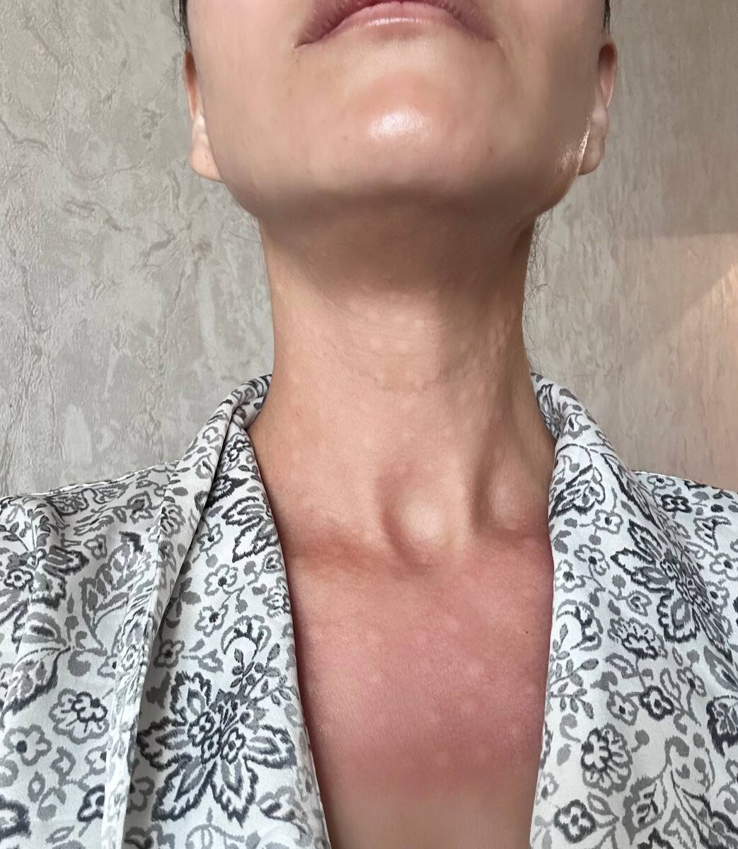 Через 2 часа после процедуры