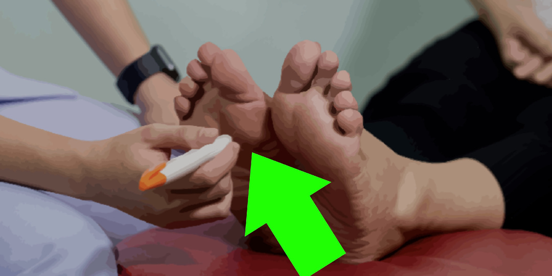 Контроль над нейропатической болью: тактика невролога и эндокринолога