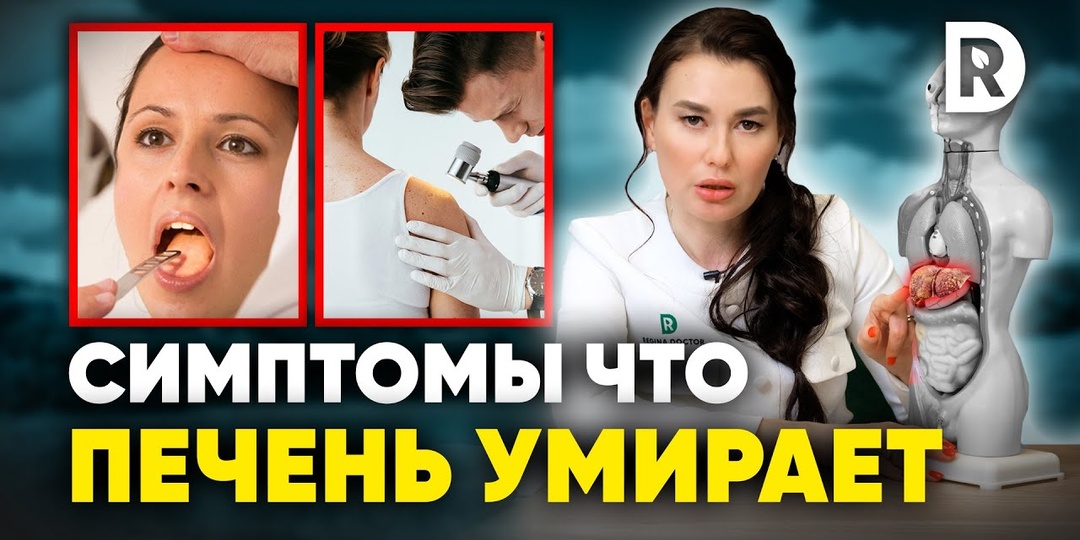 Врач случайно обнаружил рак печени при проверке желчного (история)