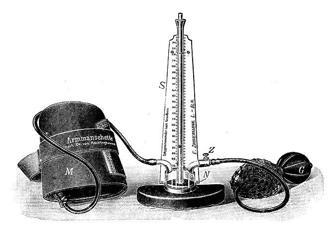 Аппарат Рива-Роччи