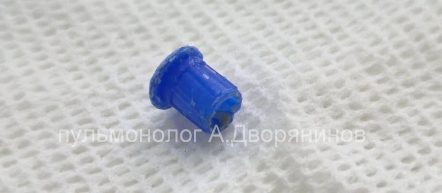    Колпачок теперь находится в эндоскопическом музее детской областной больницы