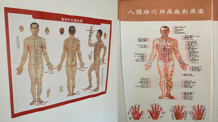 7000 жизненно важных точек на теле.