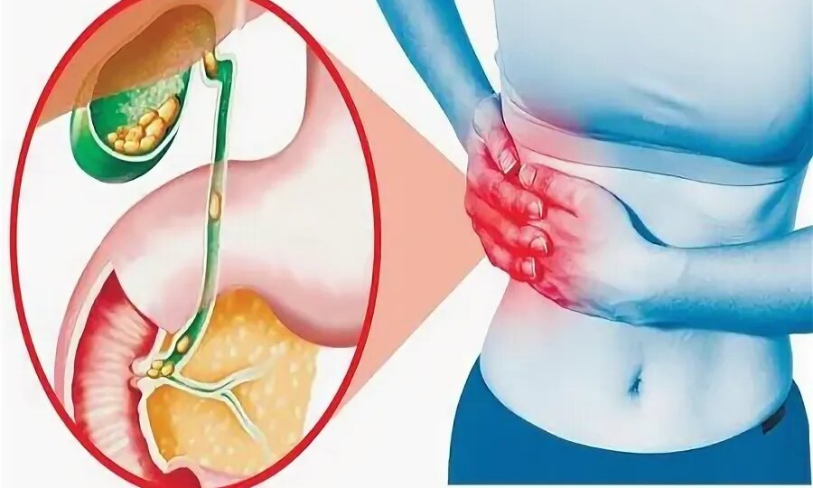 9 сигналов, что с желчным пузырём пора разобраться — пока не стало поздно