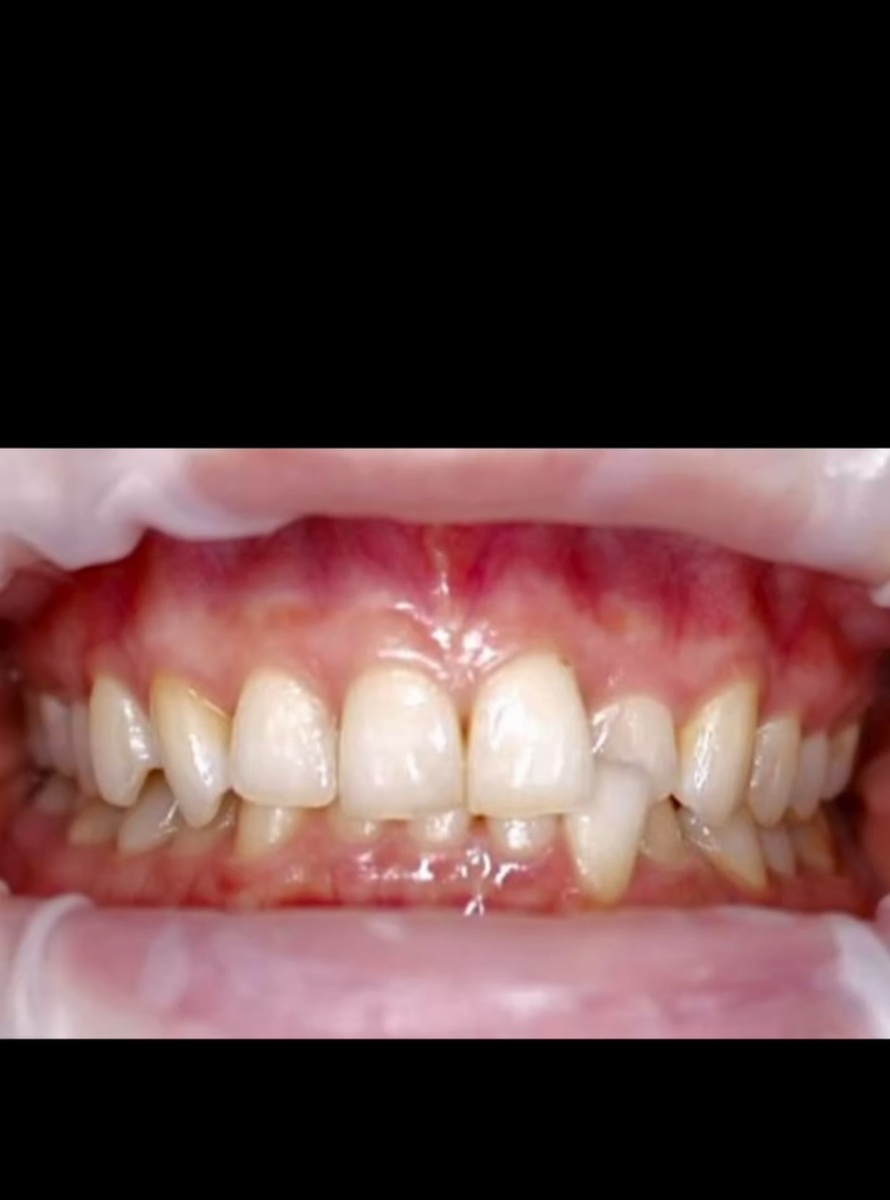 Фото до лечения