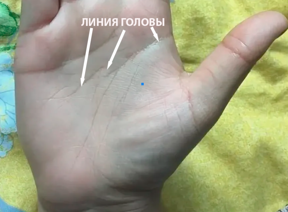 Линия Головы имеет разрыв, точки и оканчивается островом