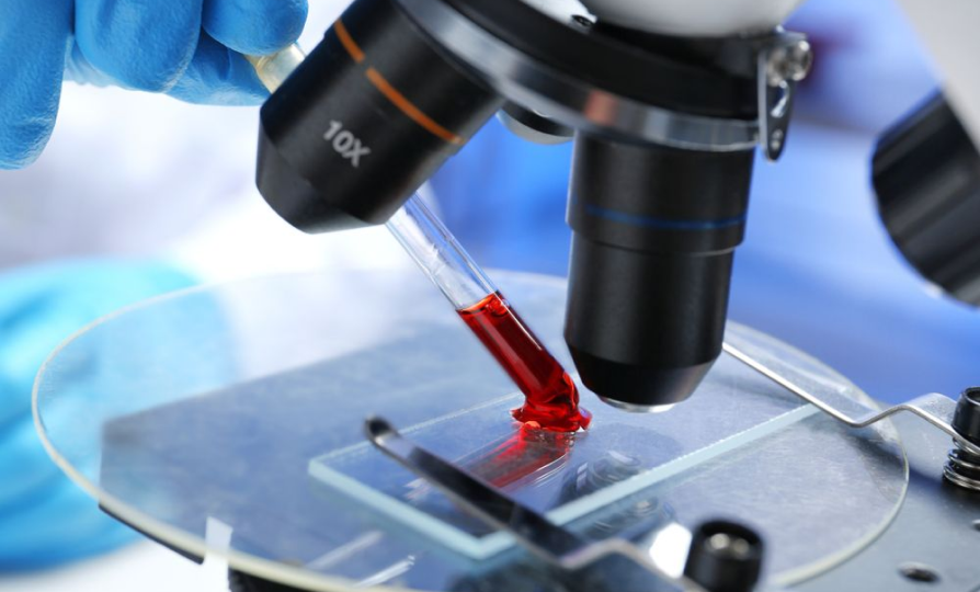 Всего один анализ поможет предотвратить подагру и камни в почках