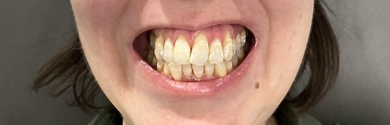 Состояние до